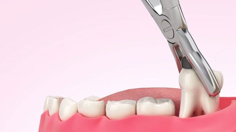 w9rdl4ss 84eacbd6254cc81965e910ae5596a53e1733900853