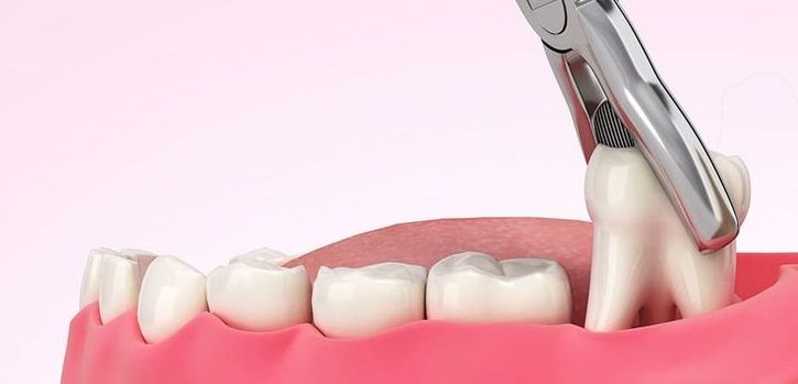 w9rdl4ss 84eacbd6254cc81965e910ae5596a53e1733900853